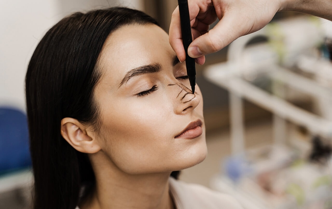 Should I Get Rhinoplasty? A Complete Guide with Everything You Need to Know