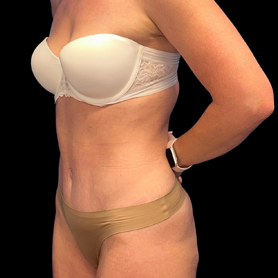 Side view of a woman in lingerie.